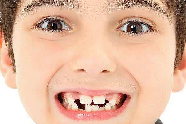 孩子换牙，牙齿长得很丑、不整齐怎么办？其实不用太担心！
